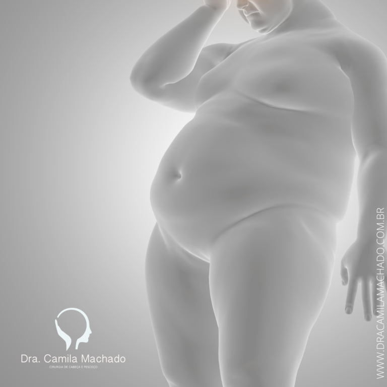 Obesidade e Cancer de Tireoide