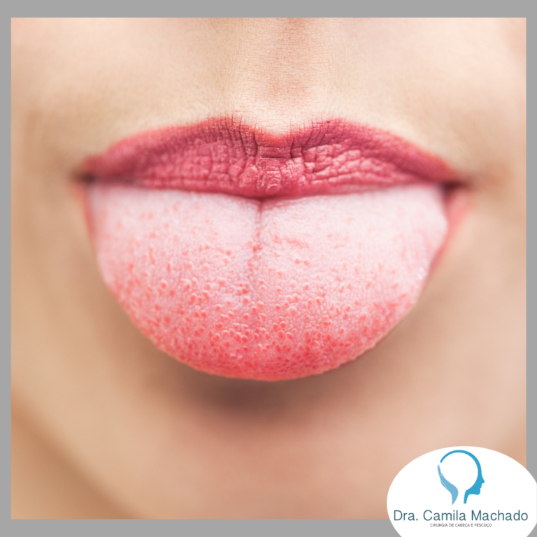 O que são Leucoplasia e Eritroplasia?